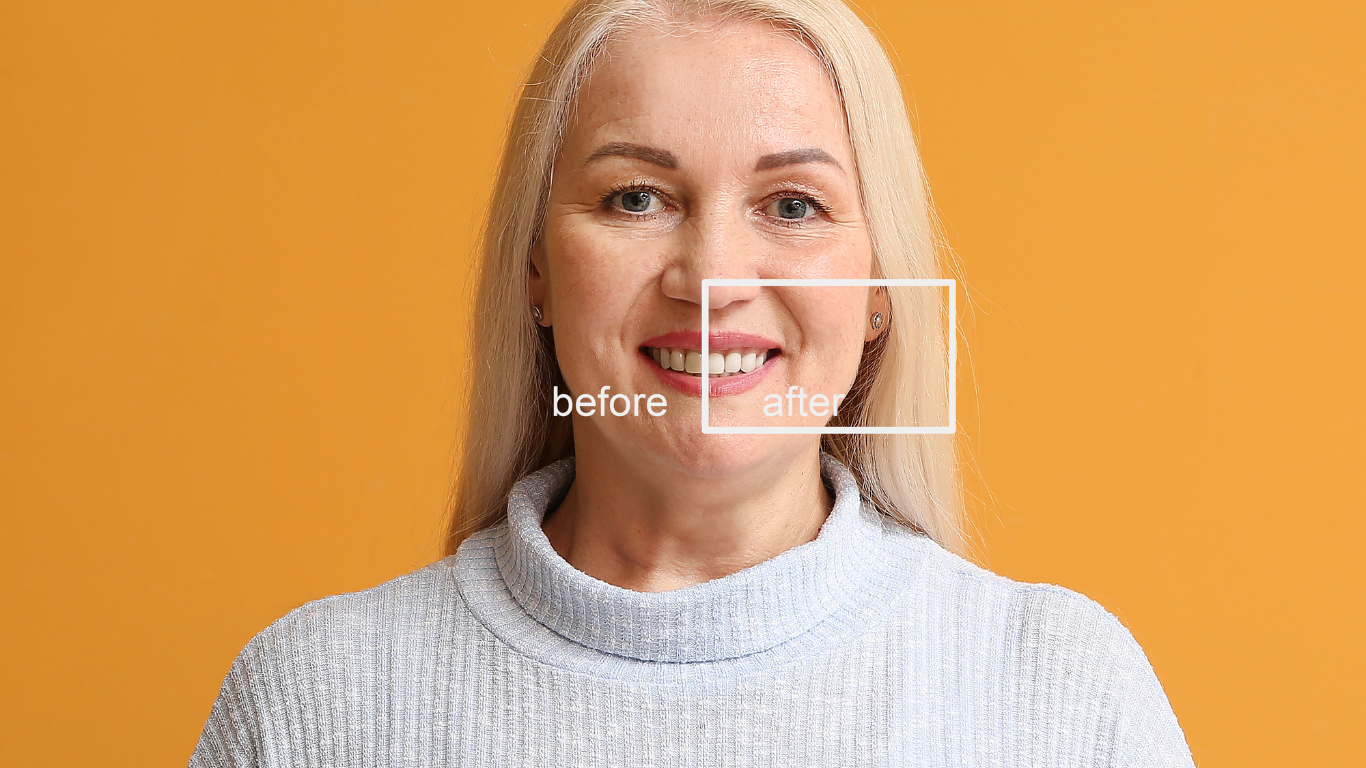 smile makeover service in Thiruvalla&Kakkanad