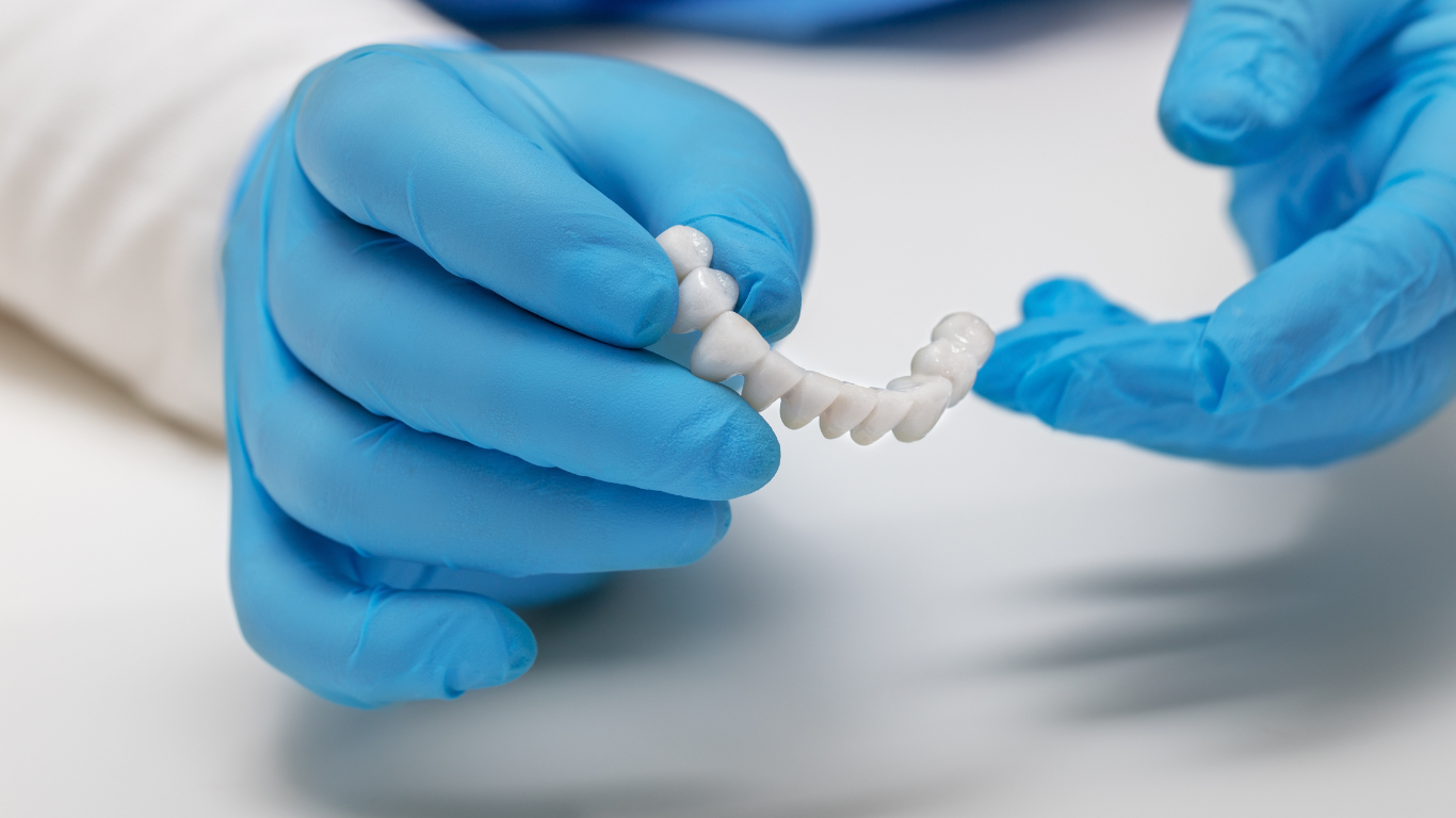 Crowns and Bridges treatment in Thiruvalla&Kakkanad