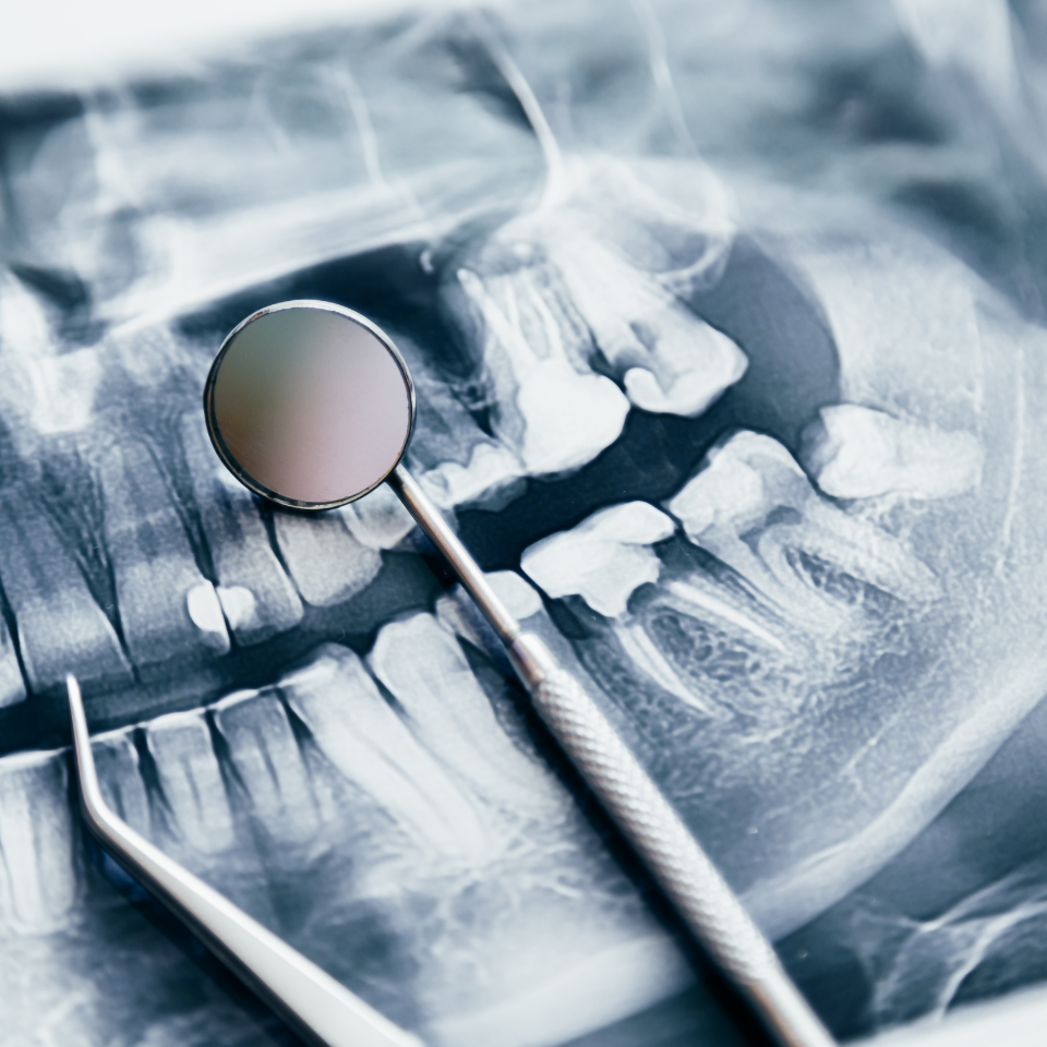 Blue - Tinted Dental X- ray - image