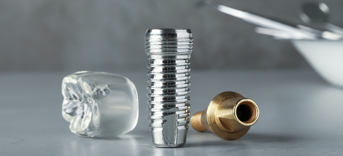 "The Importance of Choosing the Right Dentist for Your Implants "