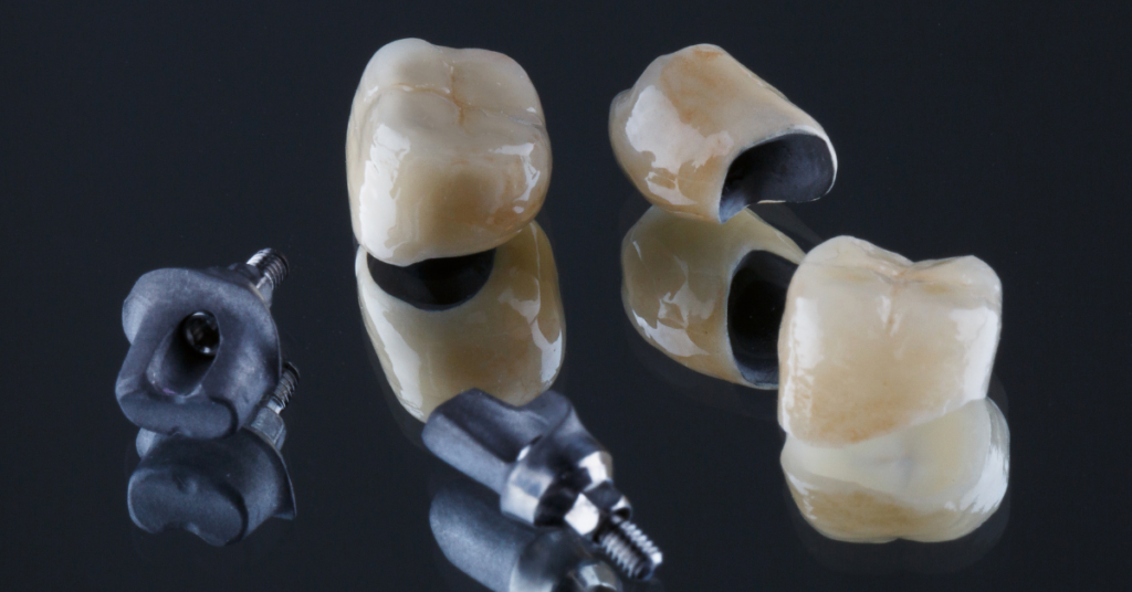 "Signs You Might Need a Dental Crown: Beyond the Crack "