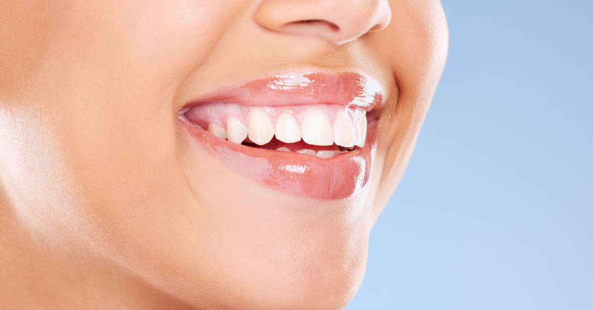 How Dental Checkups and Cleanings Help You Save Money: Preventative Dental Care