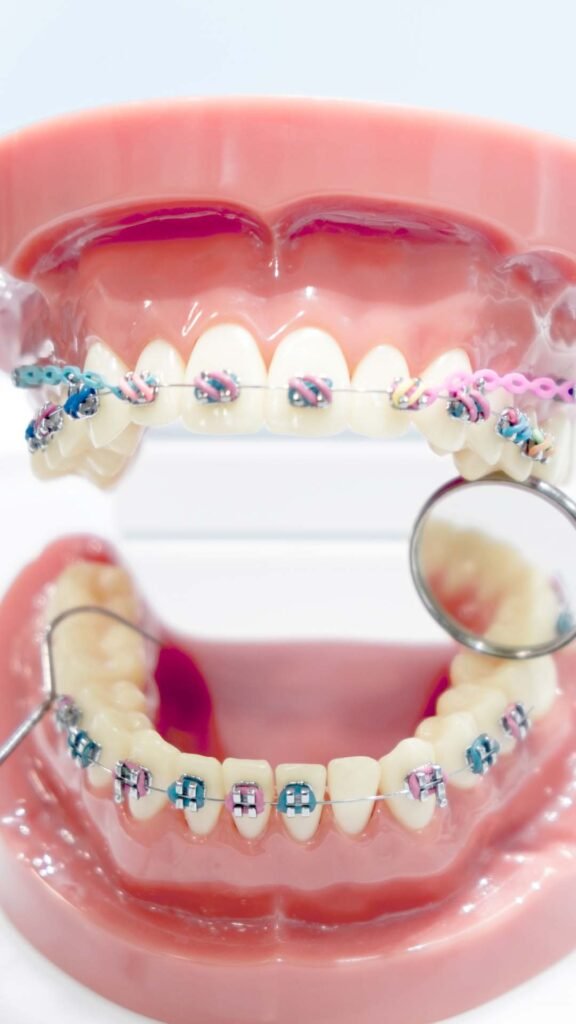 Orthodontics Treatment in Thiruvalla & Kakkanad