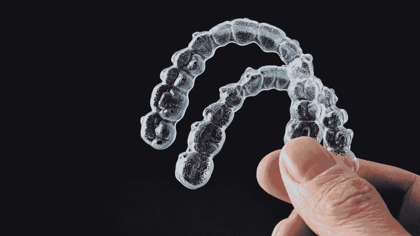 Clear Aligners in Thiruvalla & Kakkanad