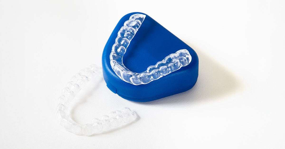 What Are Clear Aligners? A Complete Beginner’s Guide