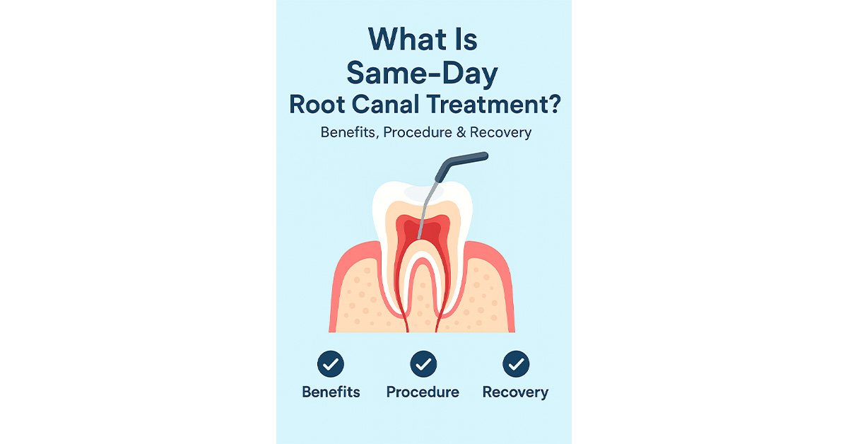 What Is Same-Day/ Single Visit Root Canal Treatment? Benefits, Procedure & Recovery